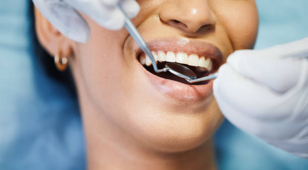 Best Emergency Treatment for Toothache in Orem, UT