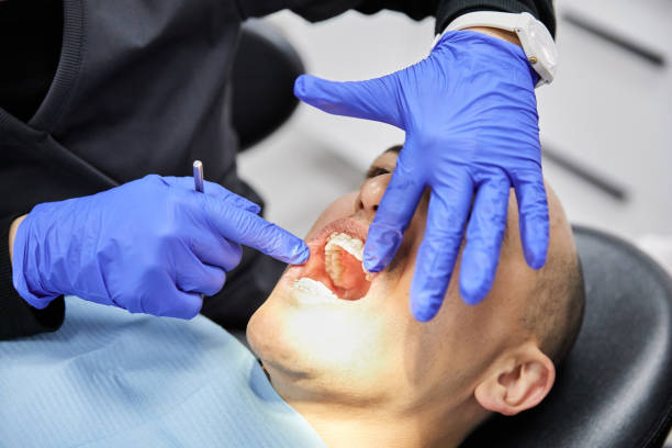 Best Emergency Tooth Extraction in Orem, UT